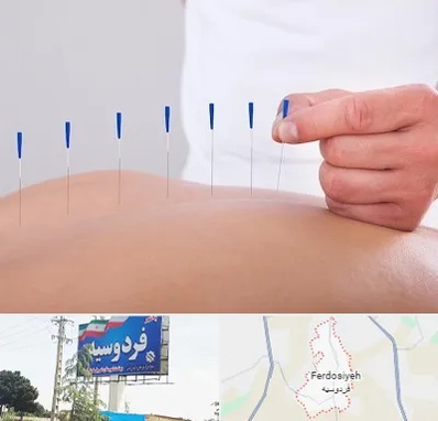 دکتر طب سوزنی در فردوسیه شهریار