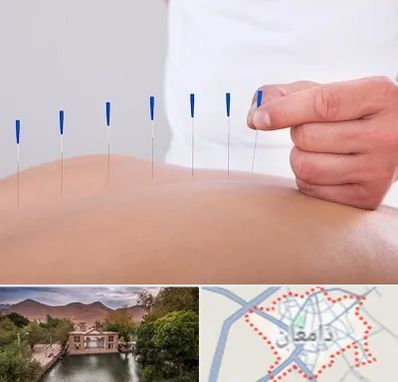 دکتر طب سوزنی در دامغان