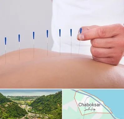 دکتر طب سوزنی در چابکسر