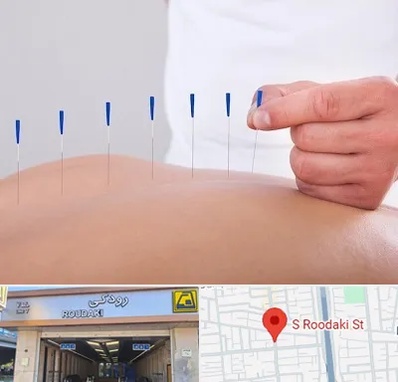 دکتر طب سوزنی در رودکی