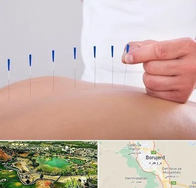 دکتر طب سوزنی در بروجرد