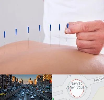 دکتر طب سوزنی در نواب