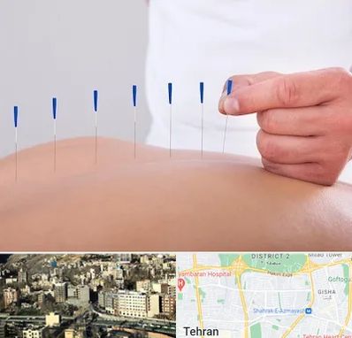 دکتر طب سوزنی در مرزداران 