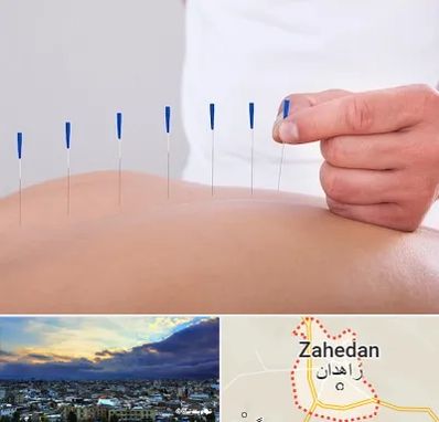 دکتر طب سوزنی در زاهدان