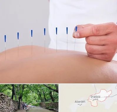 دکتر طب سوزنی در شاندیز مشهد