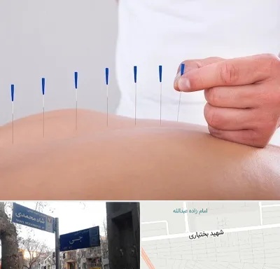 دکتر طب سوزنی در سی متری جی