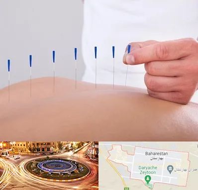 دکتر طب سوزنی در بهارستان