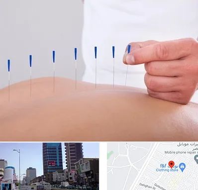 دکتر طب سوزنی در چهارراه طالقانی کرج