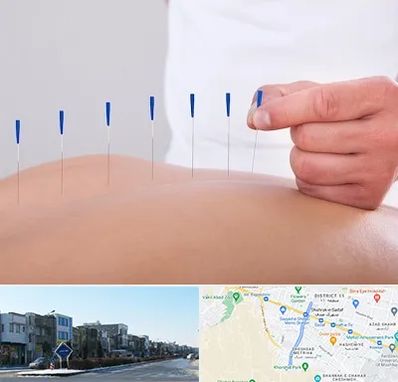 دکتر طب سوزنی در شریعتی مشهد