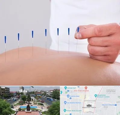 دکتر طب سوزنی در بهارستان 