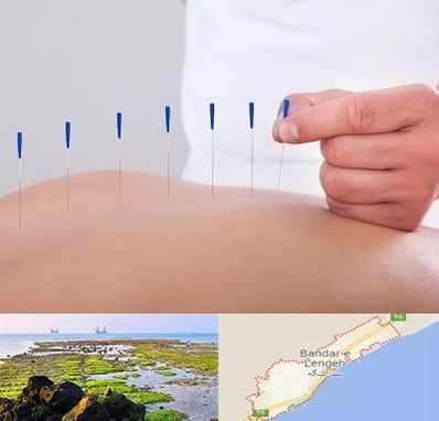 دکتر طب سوزنی در بندرلنگه