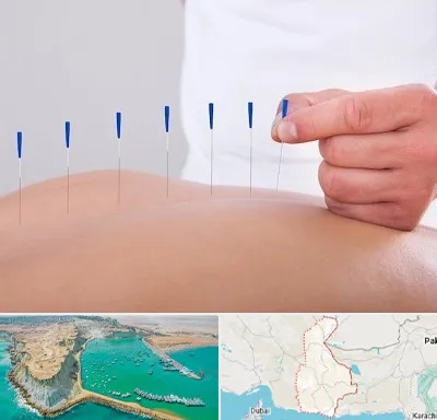 دکتر طب سوزنی در سیستان و بلوچستان