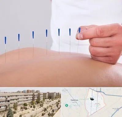 دکتر طب سوزنی در واوان اسلامشهر