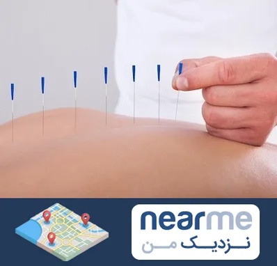دکتر طب سوزنی در نزدیک من