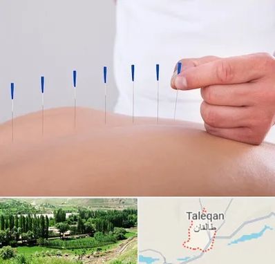 دکتر طب سوزنی در طالقان