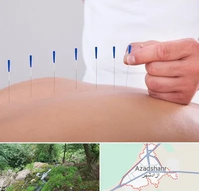 دکتر طب سوزنی در آزادشهر