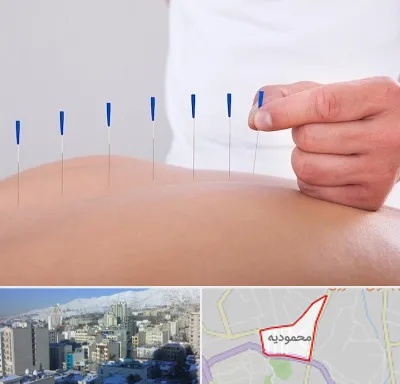 دکتر طب سوزنی در محمودیه