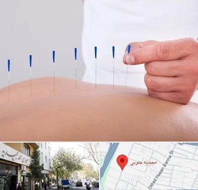 دکتر طب سوزنی در مجیدیه جنوبی