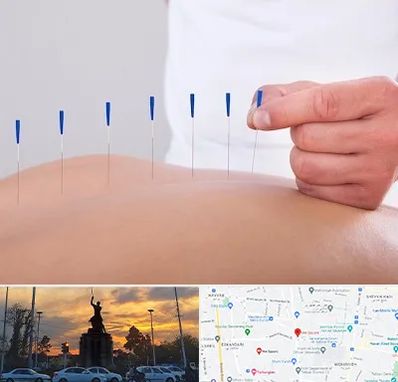 دکتر طب سوزنی در میدان حر