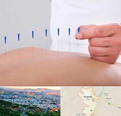 دکتر طب سوزنی در سنندج