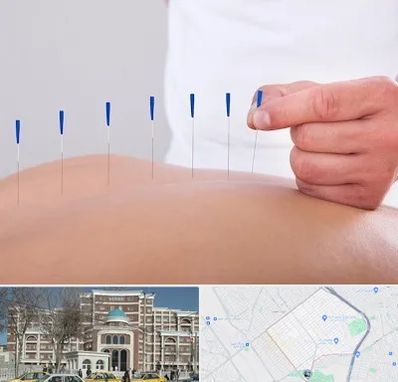 دکتر طب سوزنی در طلاب مشهد