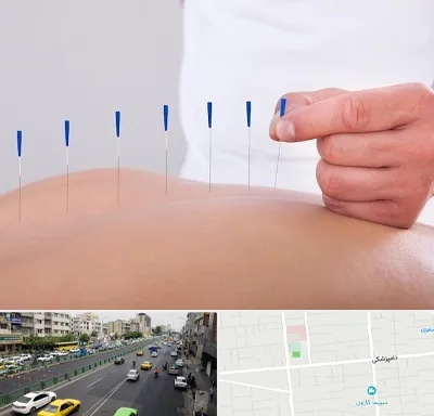 دکتر طب سوزنی در خیابان دامپزشکی