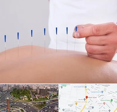 دکتر طب سوزنی در سبلان