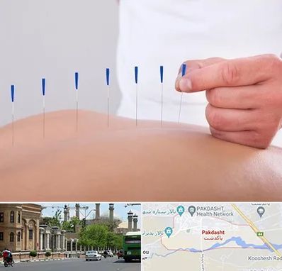 دکتر طب سوزنی در پاکدشت