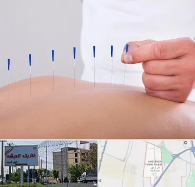 دکتر طب سوزنی در فاز یک اندیشه