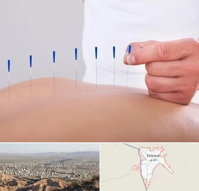 دکتر طب سوزنی در اسفراین