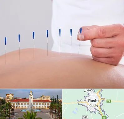 دکتر طب سوزنی در رشت