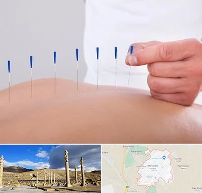 دکتر طب سوزنی در مرودشت