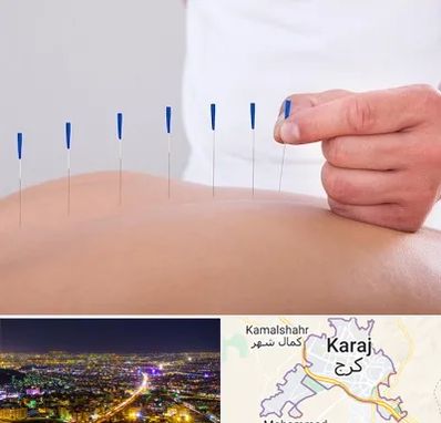 دکتر طب سوزنی در کرج