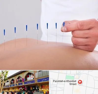 دکتر طب سوزنی در 15 خرداد