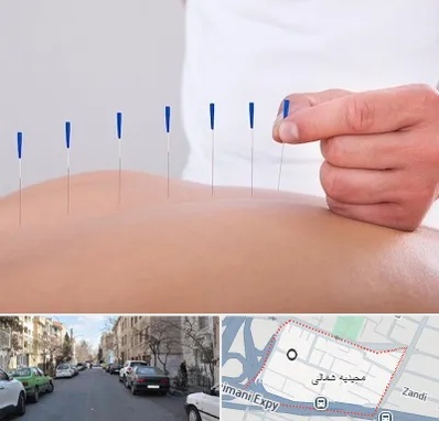 دکتر طب سوزنی در مجیدیه شمالی