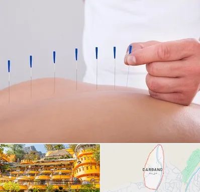 دکتر طب سوزنی در دربند