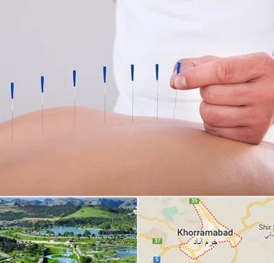 دکتر طب سوزنی در خرم آباد