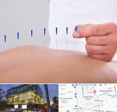 دکتر طب سوزنی در جمهوری 