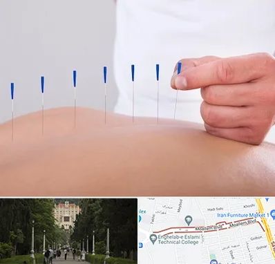 دکتر طب سوزنی در بلوار معلم رشت