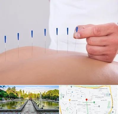 دکتر طب سوزنی در سرسبز