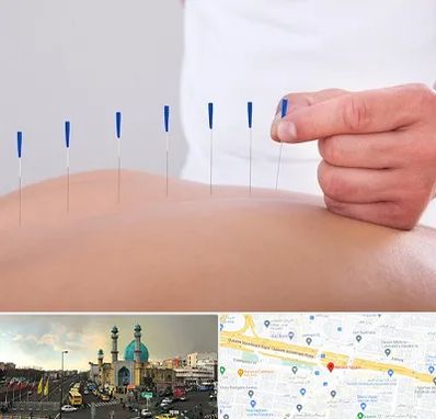 دکتر طب سوزنی در رسالت