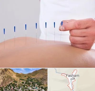 دکتر طب سوزنی در فشم