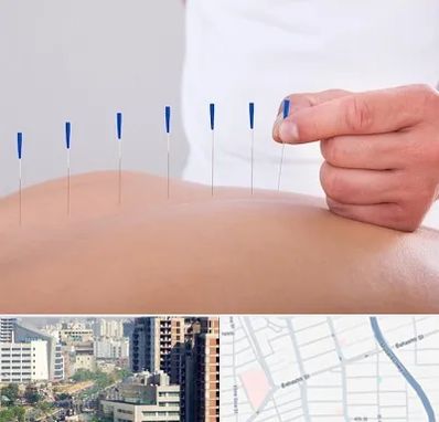 دکتر طب سوزنی در خیابان بهشتی