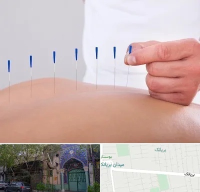 دکتر طب سوزنی در بریانک