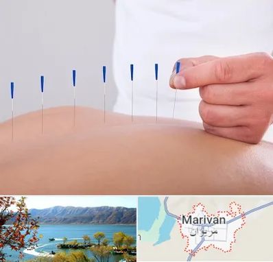 دکتر طب سوزنی در مریوان