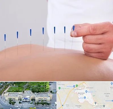 دکتر طب سوزنی در نسیم شهر