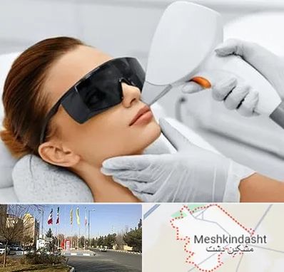 مرکز لیزر مو در مشکین دشت