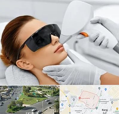 مرکز لیزر مو در شاهین ویلا کرج