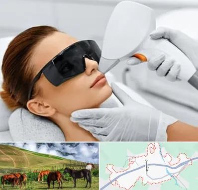 مرکز لیزر مو در تالش