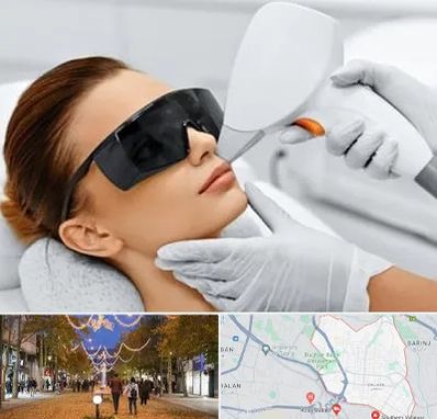 مرکز لیزر مو در ولیعصر ارومیه